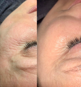 Organic Beauty - Infuzja tlenowa DermaOxy