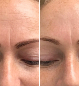 Organic Beauty - Infuzja tlenowa DermaOxy